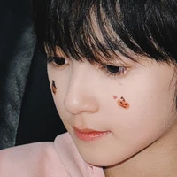Con tg mê Kiệt Trí giai đoạn cuối