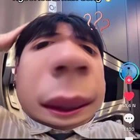 T/G Bị Khòn