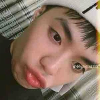 Hệ thống ( chíp bông)